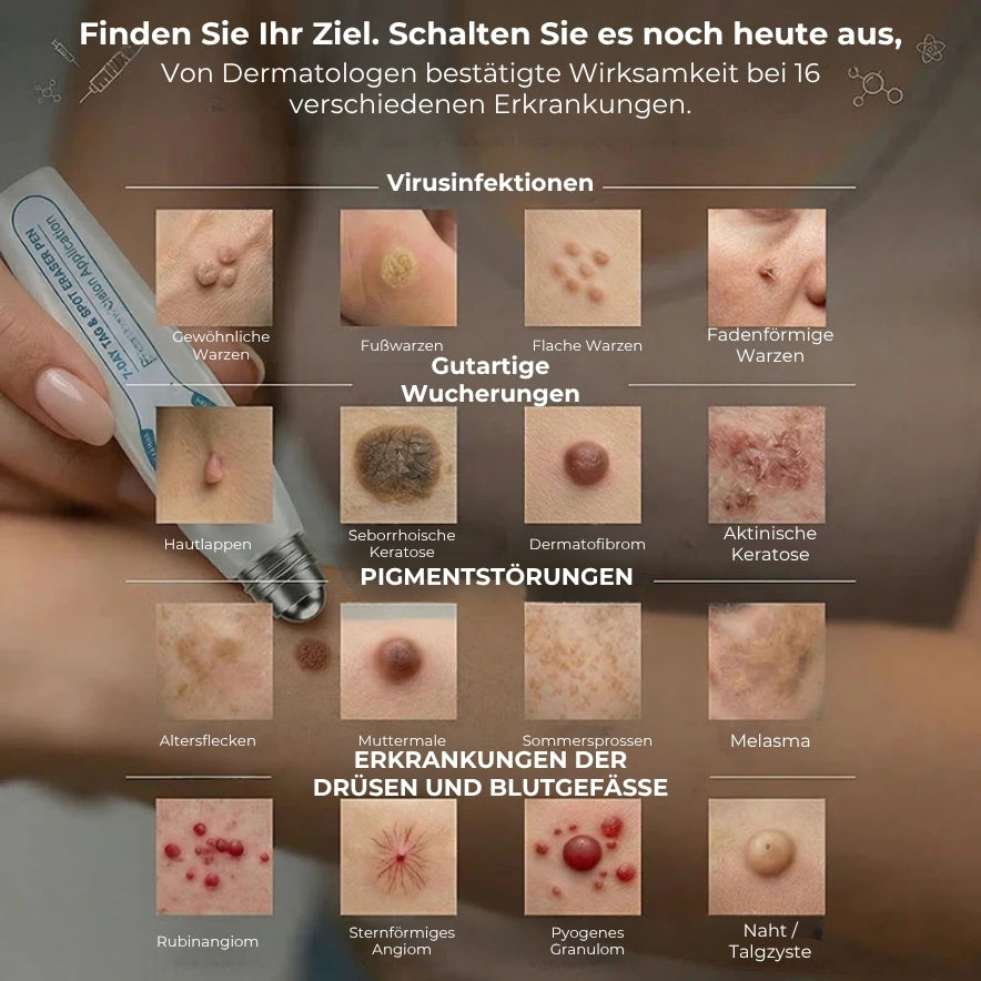 Hochwertiger Roller zur Entfernung von Hautanhängseln und Warzen
